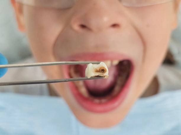 Best Same-Day Emergency Dentist in Hopwood, PA