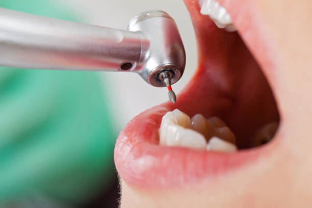 Best Emergency Wisdom Teeth Removal in Hopwood, PA